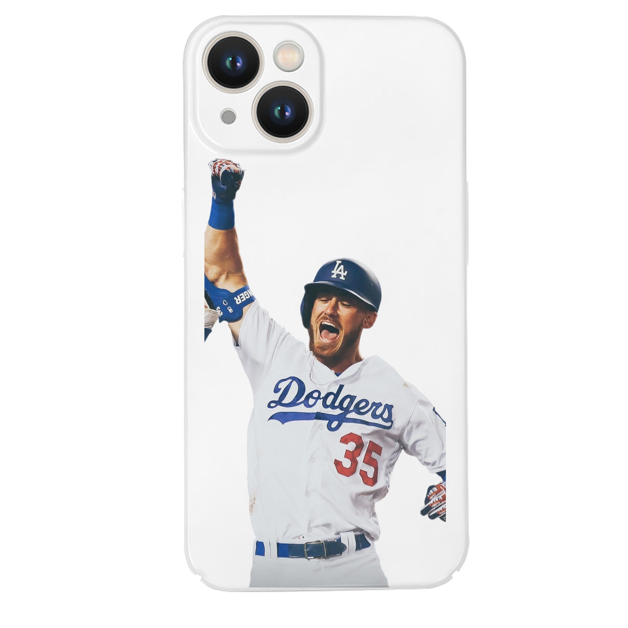  IPhone 14 Series Full-Cover Hard Case – Shockproof With Raised Camera Protection – Precise Cutouts, Wireless Charging Compatible – Durable, Anti-Yellowing, Easy To Clean